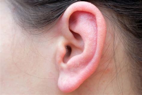 What Cause Dry Skin In Ears